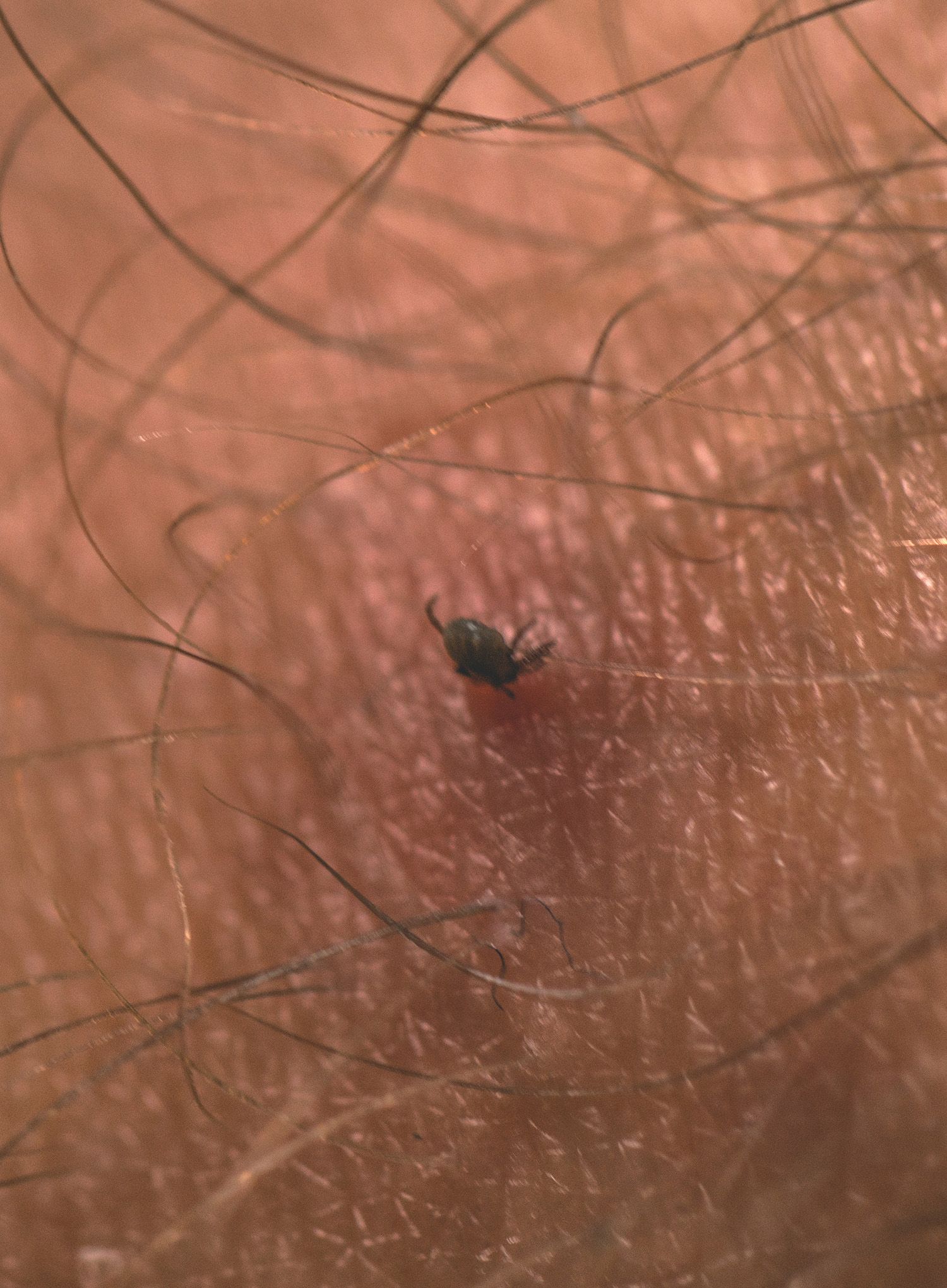 Karta na klíšťata Lifesystems Tick Remover Card